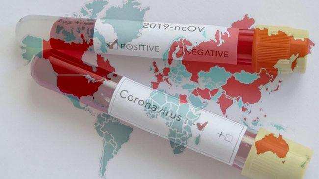 Dünyada ve Türkiye’de Koronavirüs salgınında son 8 ayın değerlendirilmesi (11 Mart-31 Ekim 2020)